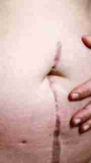 img-cc73cabce59e5d0e1e952000dde481f9.jpg